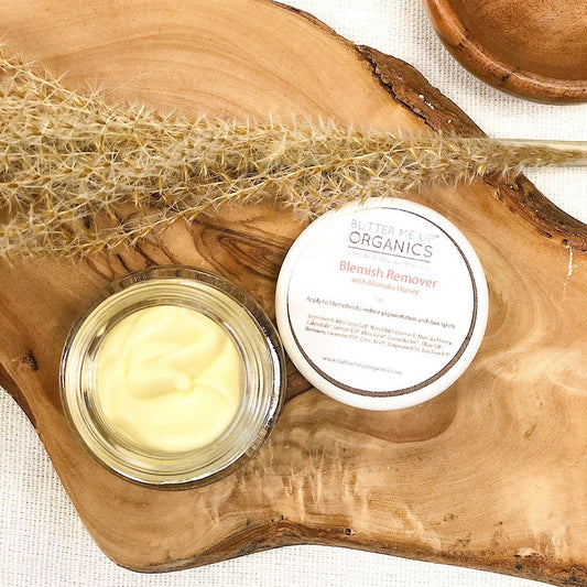 Organic Blemish Cream/ Dark Spot Remover / Scar Cream / Acne Spot Treatment - Homeland Harvest