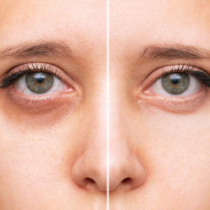 Under-Eye Color Corrector Concealer | Dark Circles